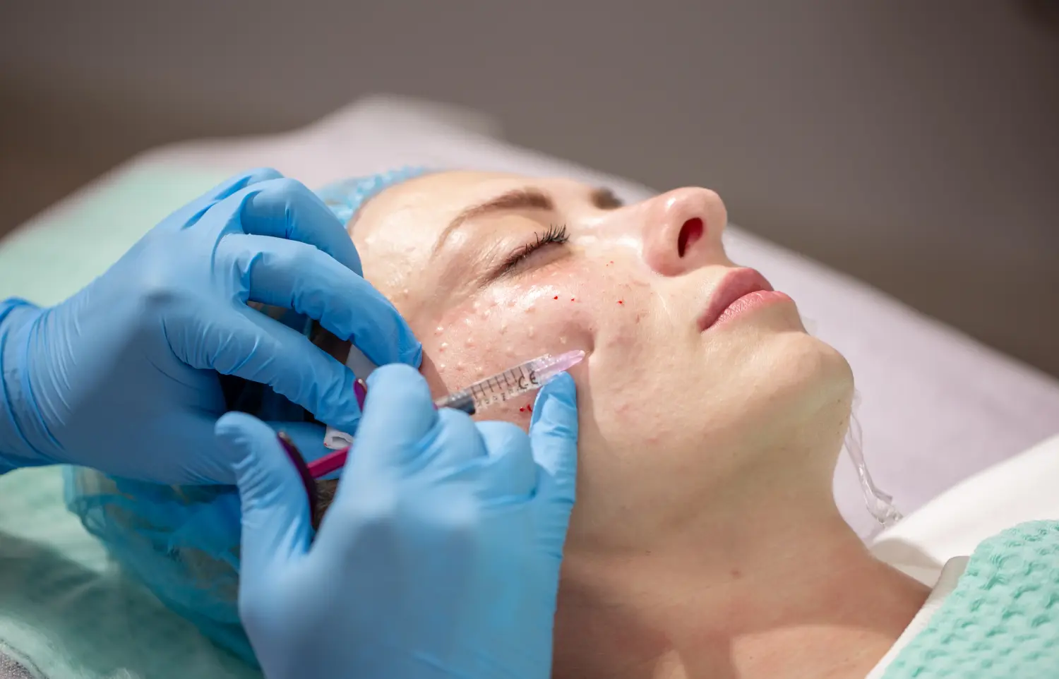 Mesotherapie Medical Touch