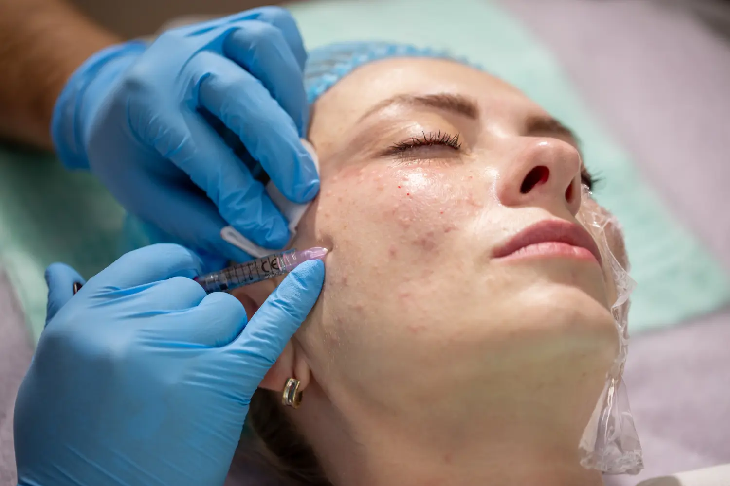 Mesotherapie Medical Touch