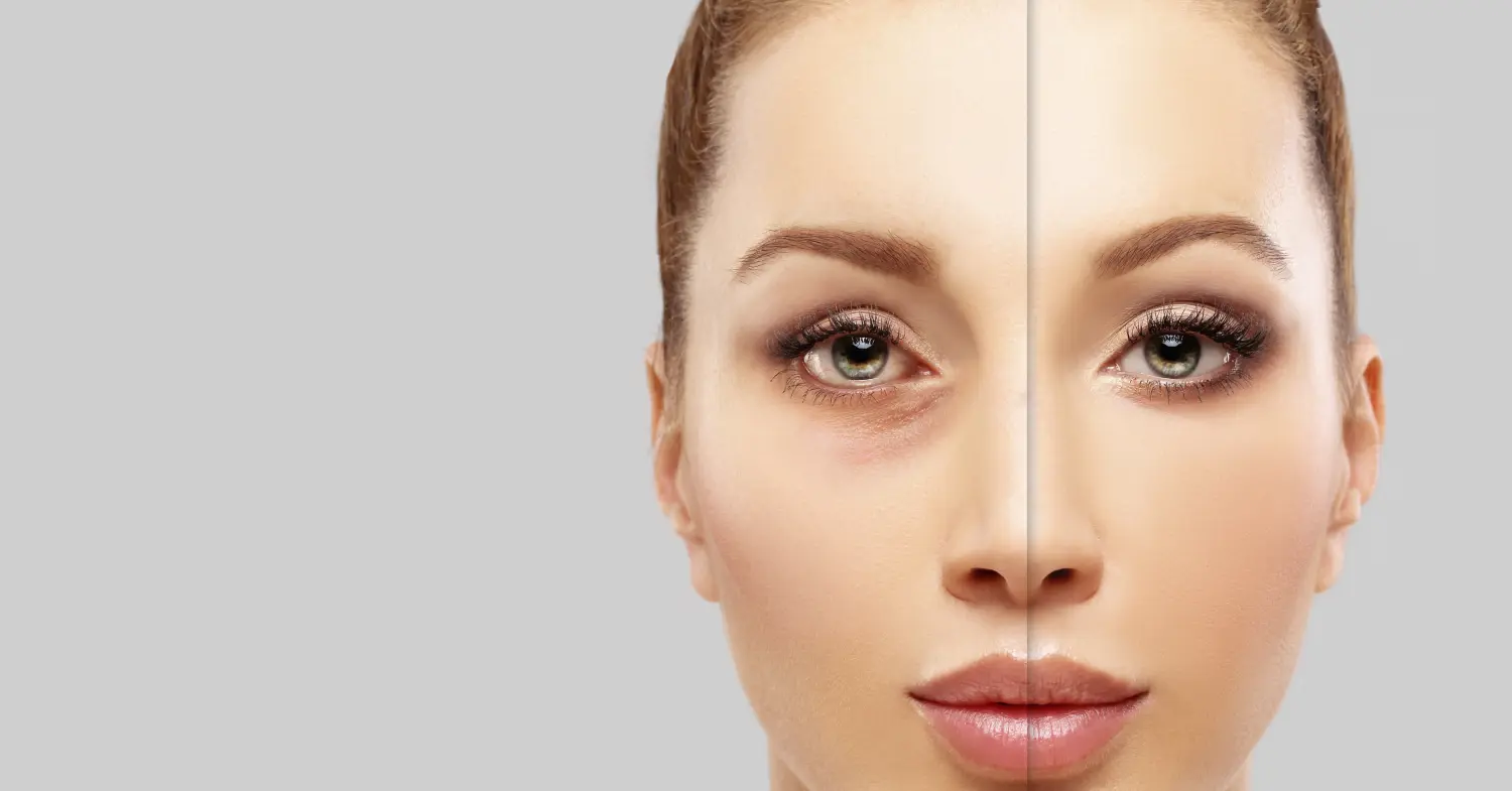 Biorevitalisierung Medical Touch