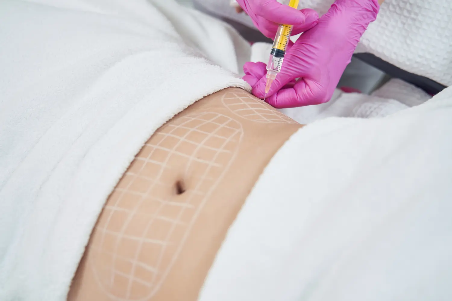 Fettabbau-Injektion Medical Touch